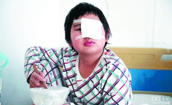 中 초등생, 숙제안해 따귀 맞고 실명