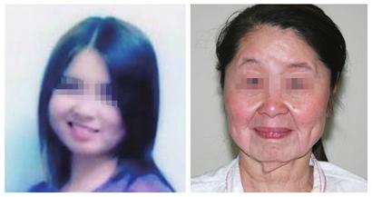 20대 여성, 출산 후 60대로 변해
