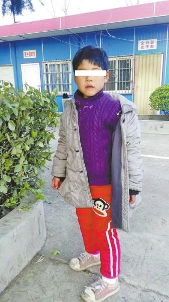 치료한다더니 6살 장애아 무차별 폭행