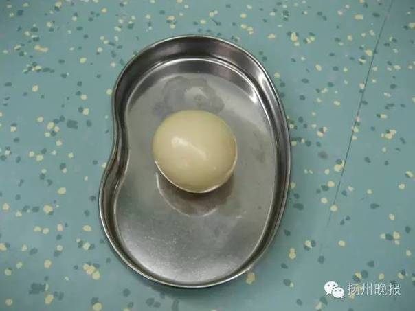 '알' 낳은 중국남성...정체는?