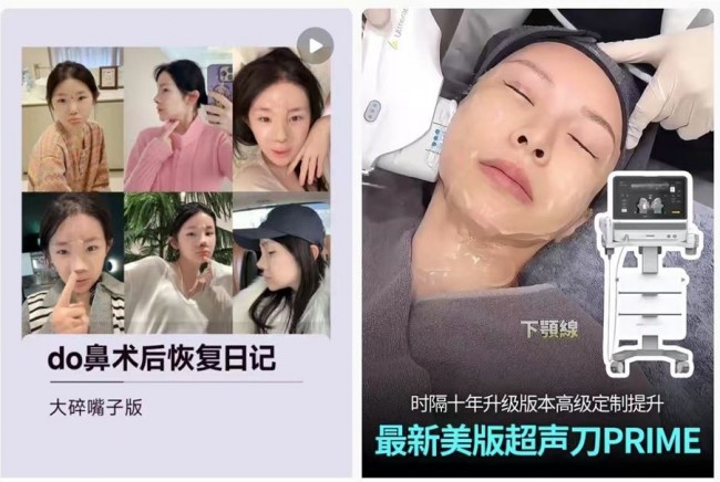 한국 찾는 중국인, 다시 미용 관광 붐